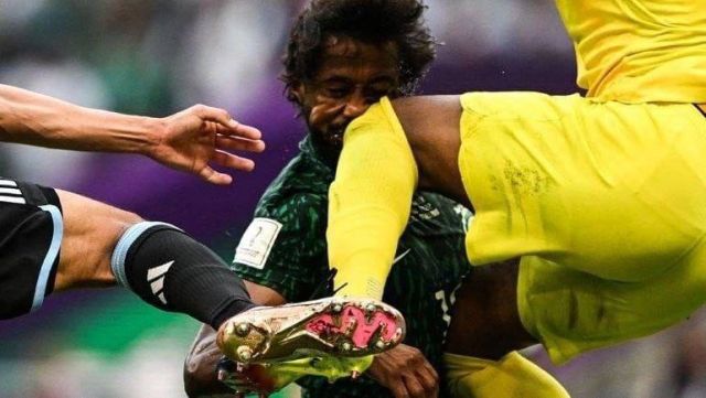 Вратарь Саудовской Аравии травмировал защитника