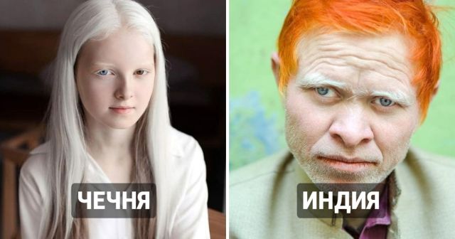 "Белые вороны": удивительные люди-альбиносы разных национальностей