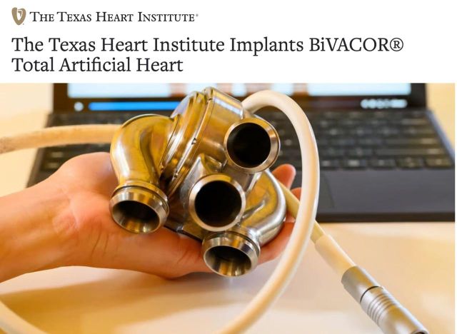 Первый настоящий киборг: в Техасе впервые успешно имплантировали человеку механическое сердце (3 фото)