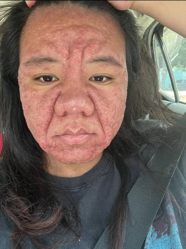 В Малайзии 28-летняя девушка из-за беременности постарела до неузнаваемости