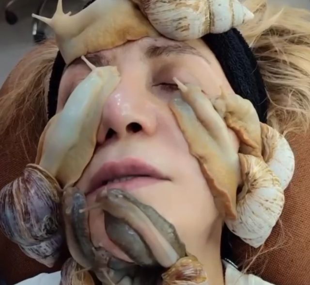 улитки на лице улитки на лице
