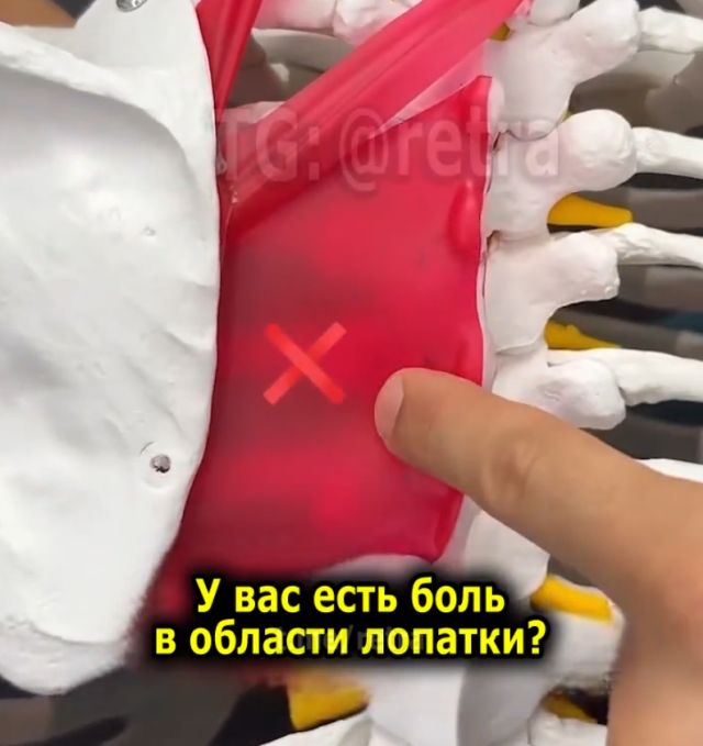 Как убрать боль в лопатках и избавиться от головной боли