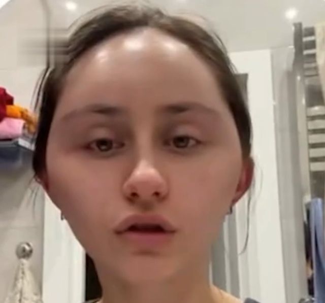 Новая фобия: москвичке раздуло голову после покраски волос