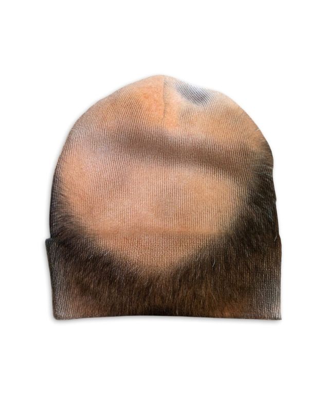 Шапки с "лысиной" завирусились в соцсетях